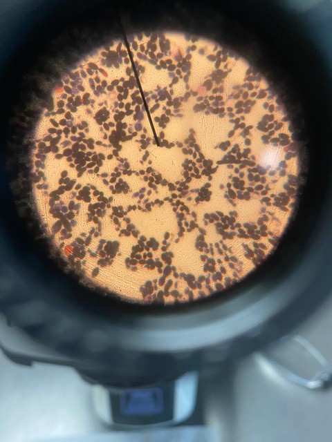 Nonalcoholic beer yeasts evaluated for fermentation activity, flavor profiles